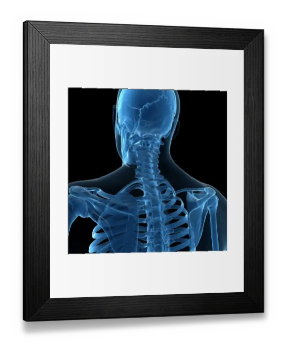 Framed Print : Upper body bones, artwork Framed Print : Upper body bones, artwork