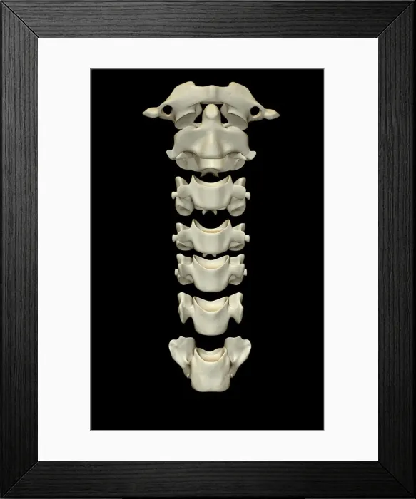 Framed Print : anatomy, atlas bone, axis bone, back bone, black background, bone, bone structure Framed Print : anatomy, atlas bone, axis bone, back bone, black background, bone, bone structure