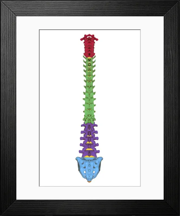 Framed Print : anatomy, back bone, back view, bone, bone structure, bones, cervical vertebrae, human Framed Print : anatomy, back bone, back view, bone, bone structure, bones, cervical vertebrae, human