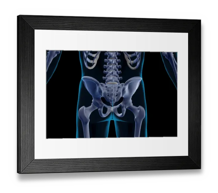 Framed Print : anatomy, back, back bone structure, back bones, back view, black background, bone Framed Print : anatomy, back, back bone structure, back bones, back view, black background, bone