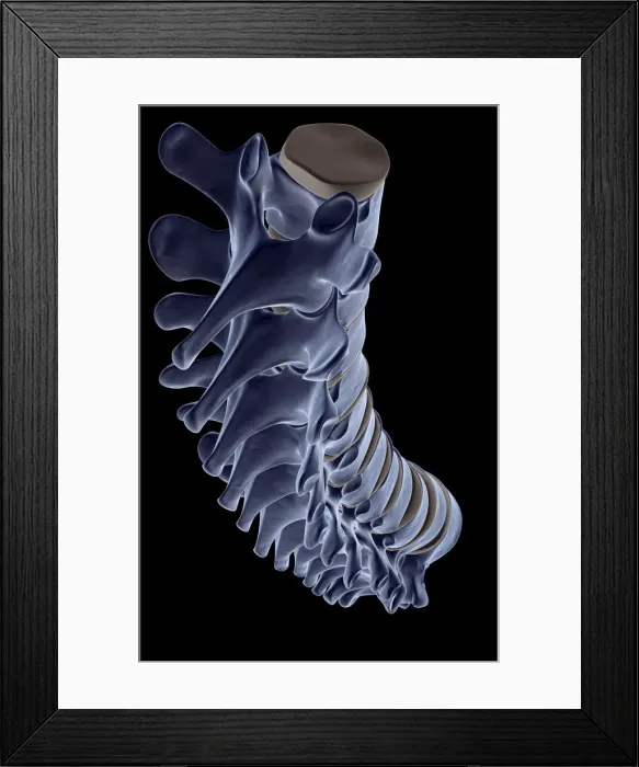 Framed Print : above view, anatomy, back bone, back view, black background, bone, bone structure