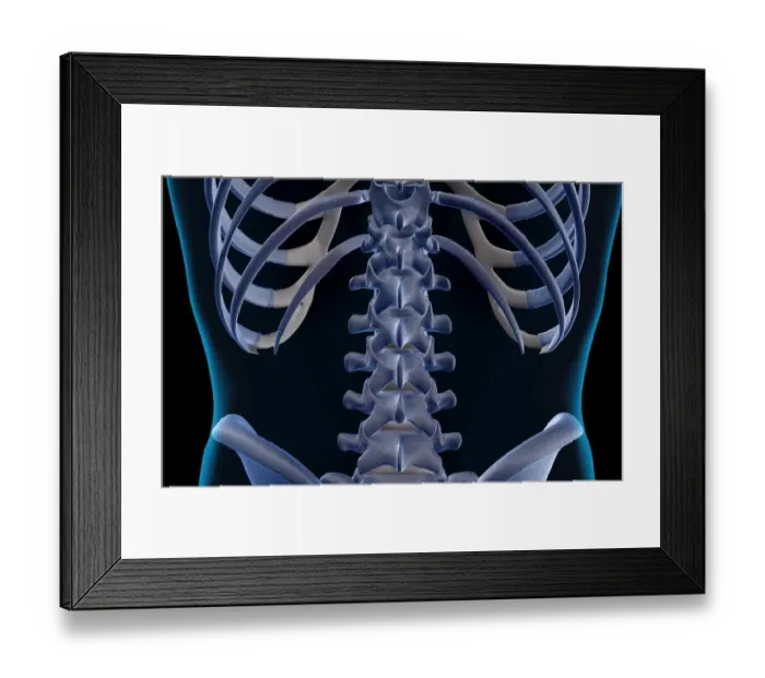 Framed Print : anatomy, back, back bone structure, back bones, back view, black background, bone Framed Print : anatomy, back, back bone structure, back bones, back view, black background, bone