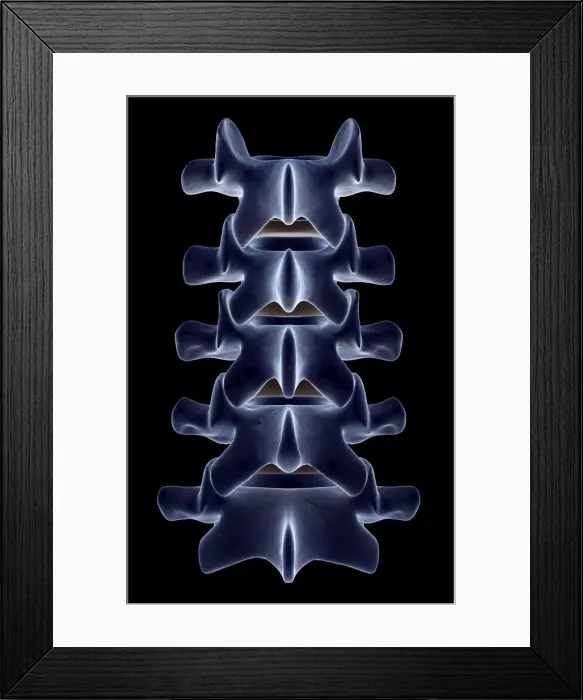 Framed Print : anatomy, back bone, back view, black background, bone, bone structure, bones, close-up view Framed Print : anatomy, back bone, back view, black background, bone, bone structure, bones, close-up view
