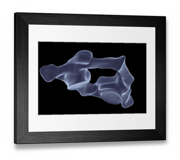 Framed Print : anatomy, atlas bone, black background, bone, bone structure, bones, cervical vertebrae Framed Print : anatomy, atlas bone, black background, bone, bone structure, bones, cervical vertebrae