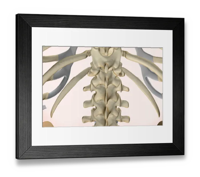 Framed Print : anatomy, back, back bone structure, back bones, back view, bone, bone structure Framed Print : anatomy, back, back bone structure, back bones, back view, bone, bone structure