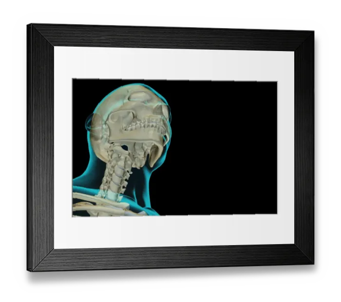 Framed Print : anatomy, below view, black background, bone, bone structure, bone structure of the head Framed Print : anatomy, below view, black background, bone, bone structure, bone structure of the head