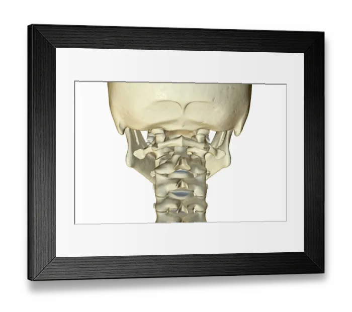 Framed Print : anatomy, back view, bone, bone structure, bone structure of the neck, bones, bones of the neck Framed Print : anatomy, back view, bone, bone structure, bone structure of the neck, bones, bones of the neck