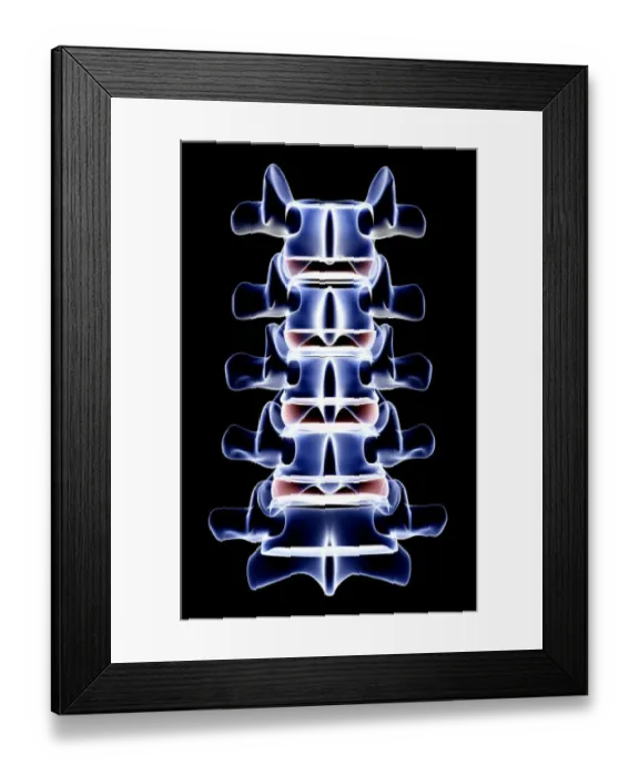 Framed Print : anatomy, back bone, back view, black background, bone, bone structure, bones, glow
