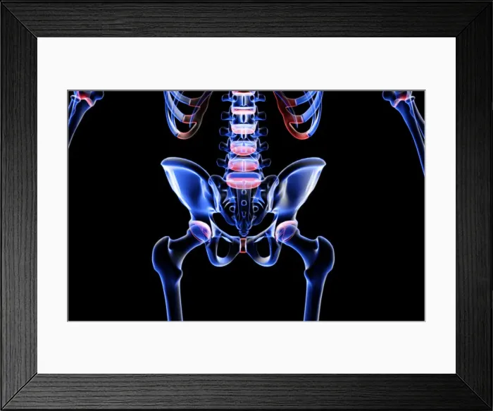 Framed Print : anatomy, back, back bone structure, back bones, back view, black background, bone Framed Print : anatomy, back, back bone structure, back bones, back view, black background, bone