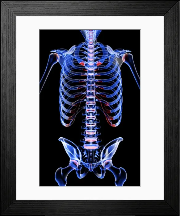 Framed Print : anatomy, back, back bone structure, back bones, back view, black background, bone Framed Print : anatomy, back, back bone structure, back bones, back view, black background, bone