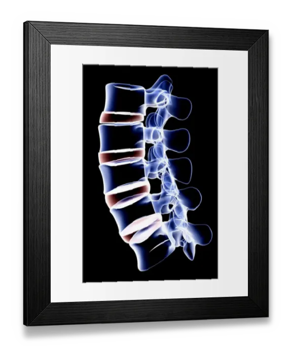 Framed Print : anatomy, back bone, black background, bone, bone structure, bones, close-up view Framed Print : anatomy, back bone, black background, bone, bone structure, bones, close-up view