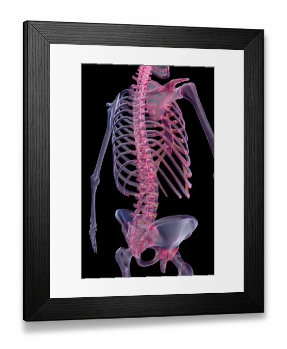 Framed Print : anatomy, back, back bone structure, back bones, back view, black background, bone Framed Print : anatomy, back, back bone structure, back bones, back view, black background, bone