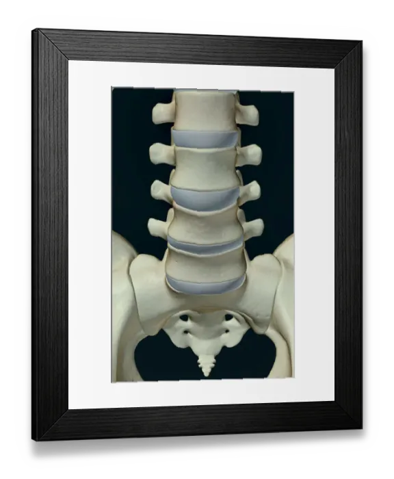 Framed Print : anatomy, black background, bone, bone structure, bone structure of the vertebrae Framed Print : anatomy, black background, bone, bone structure, bone structure of the vertebrae