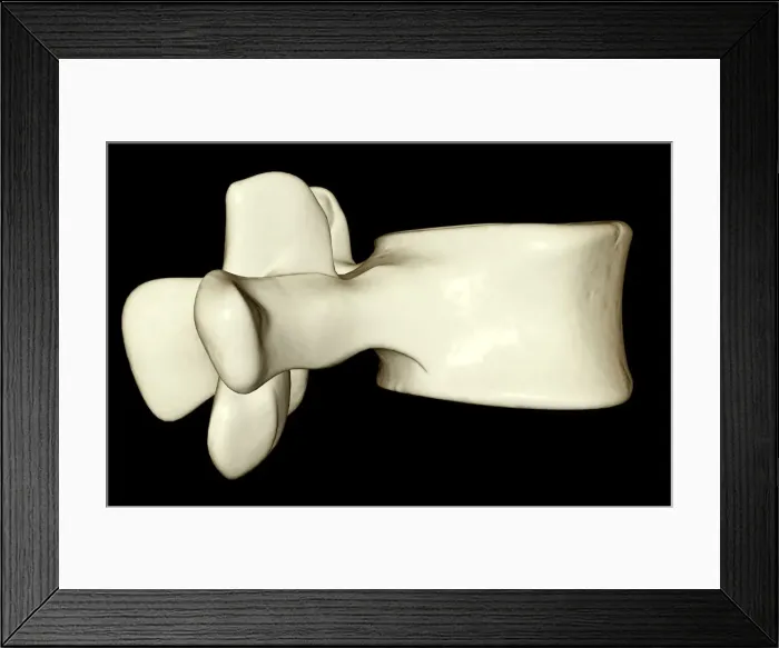 Framed Print : anatomy, black background, bone, bone structure, bones, close-up view, human, illustration Framed Print : anatomy, black background, bone, bone structure, bones, close-up view, human, illustration