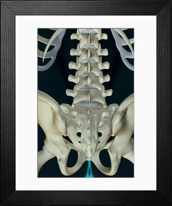 Framed Print : anatomy, back, back bone structure, back bones, back view, below view, black background Framed Print : anatomy, back, back bone structure, back bones, back view, below view, black background