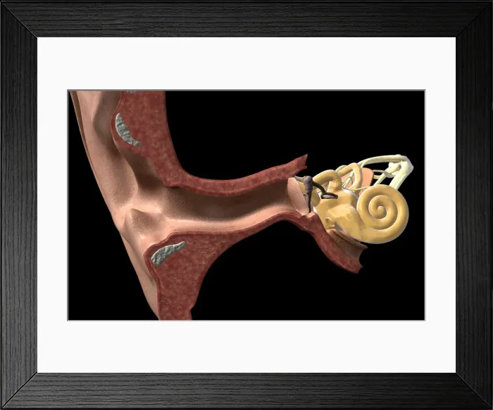 Framed Print : anatomy, auditory, auditory canal, auditory ossicles, auditory system, black background Framed Print : anatomy, auditory, auditory canal, auditory ossicles, auditory system, black background