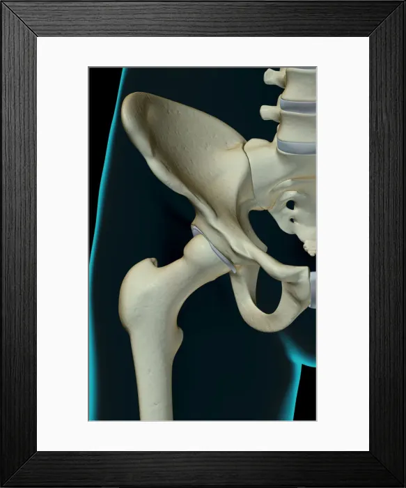Framed Print : anatomy, black background, bone, bone structure, bone structure of the hip, bones Framed Print : anatomy, black background, bone, bone structure, bone structure of the hip, bones