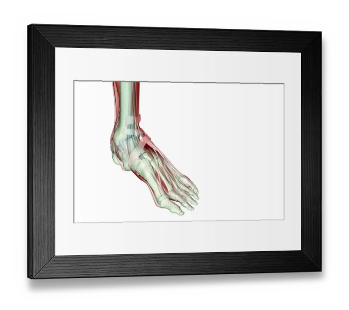 Framed Print : anatomy, dorsal interosseus, extensor digitorum longus tendons, extensor hallucis longus tendon Framed Print : anatomy, dorsal interosseus, extensor digitorum longus tendons, extensor hallucis longus tendon