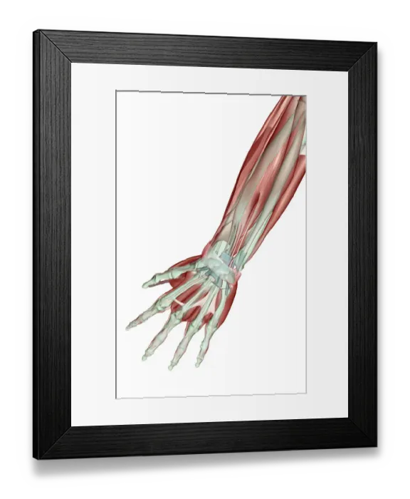 Framed Print : abductor pollicis, abductor pollicis longus, adductor digiti minimi, anatomy, arm Framed Print : abductor pollicis, abductor pollicis longus, adductor digiti minimi, anatomy, arm