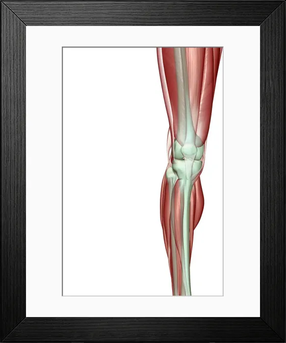Framed Print : anatomy, front view, gastrocnemius, human, illustration, knee, knee muscles, knee tendons