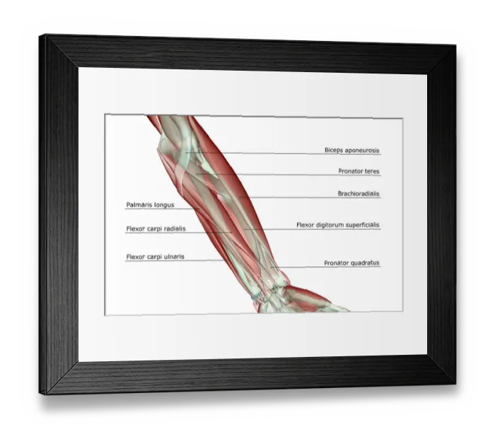 Framed Print : anatomy, arm, arm muscles, biceps aponeurosis, brachioradialis, flexor carpi radialis Framed Print : anatomy, arm, arm muscles, biceps aponeurosis, brachioradialis, flexor carpi radialis