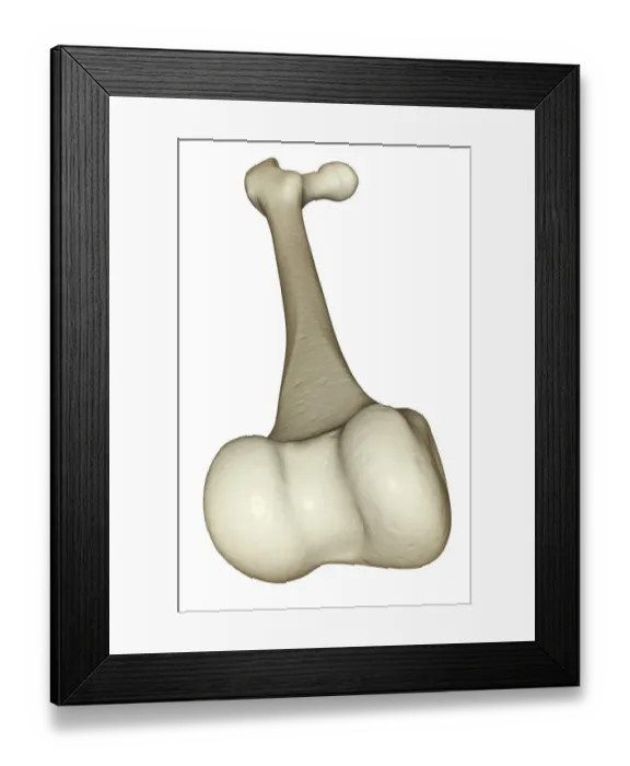 Framed Print : anatomy, back view, below view, bone, bone structure, bone structure of the leg, bones Framed Print : anatomy, back view, below view, bone, bone structure, bone structure of the leg, bones