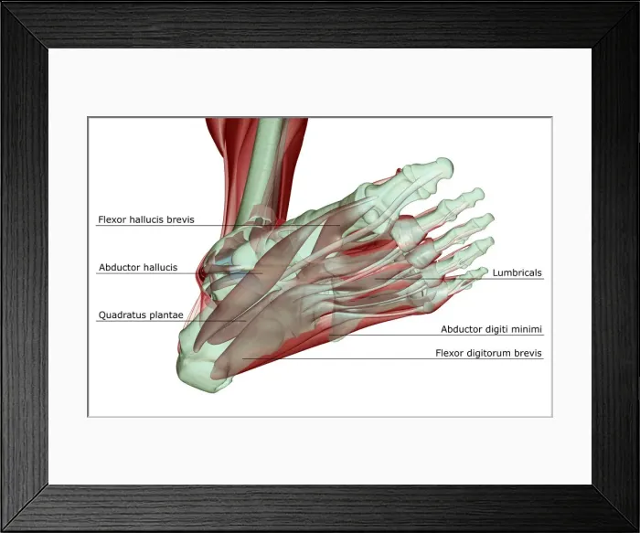 Framed Print : abductor digiti minimi, abductor hallucis, anatomy, below view, flexor digitorum brevis Framed Print : abductor digiti minimi, abductor hallucis, anatomy, below view, flexor digitorum brevis