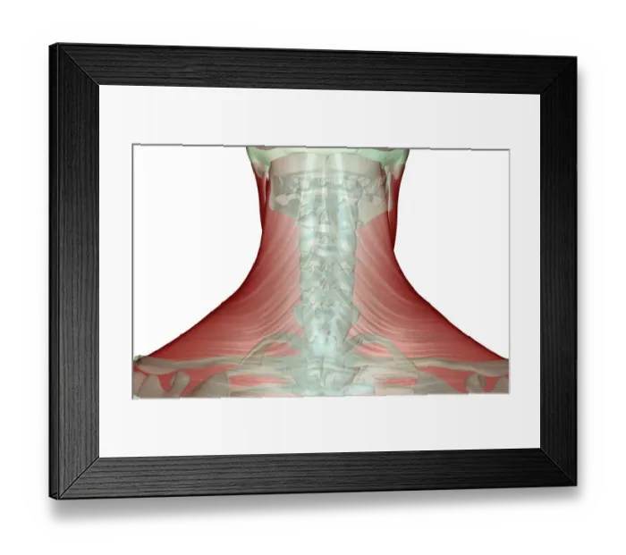 Framed Print : anatomy, back view, human, illustration, muscles, muscles of the neck, musculature Framed Print : anatomy, back view, human, illustration, muscles, muscles of the neck, musculature