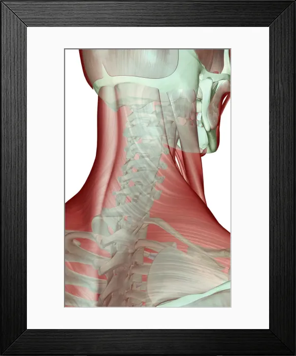 Framed Print : anatomy, back view, human, illustration, muscles, muscles of the neck, musculature Framed Print : anatomy, back view, human, illustration, muscles, muscles of the neck, musculature