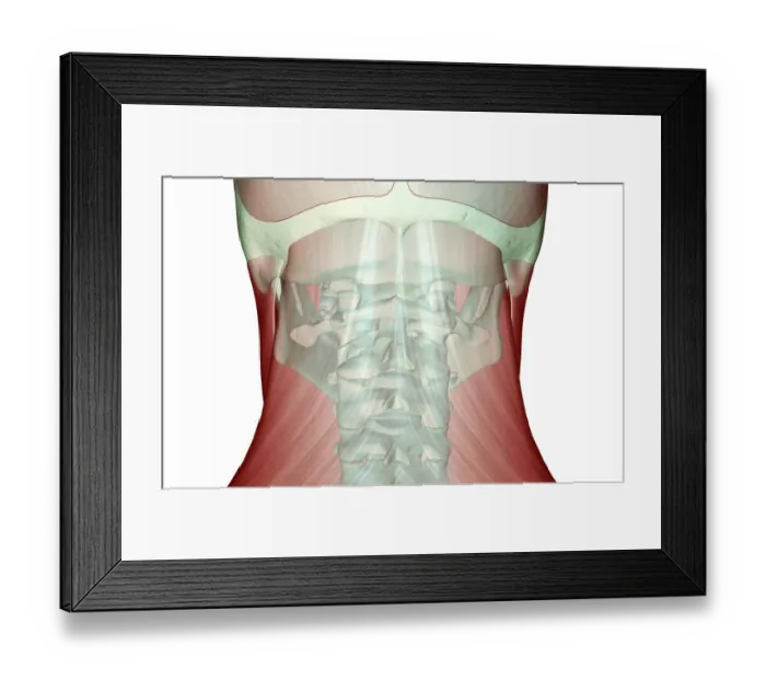 Framed Print : anatomy, back view, close-up view, human, illustration, muscles, muscles of the neck Framed Print : anatomy, back view, close-up view, human, illustration, muscles, muscles of the neck