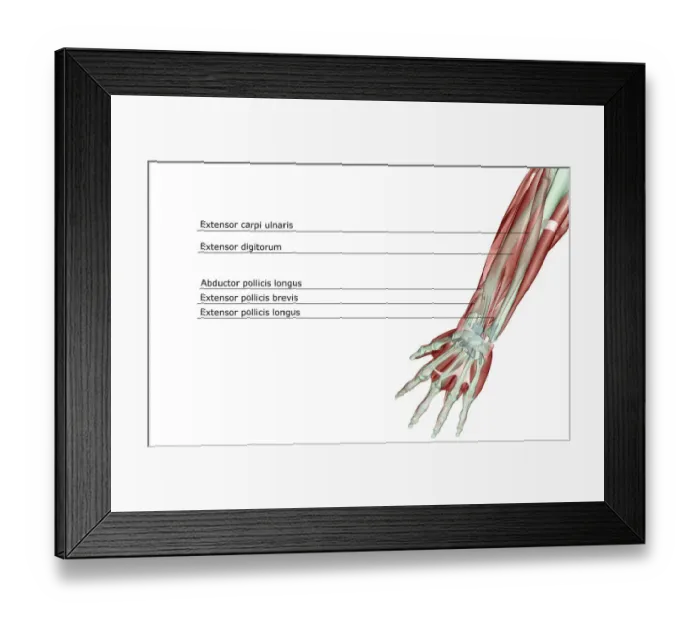 Framed Print : abductor pollicis, abductor pollicis longus, adductor digiti minimi, anatomy, arm Framed Print : abductor pollicis, abductor pollicis longus, adductor digiti minimi, anatomy, arm