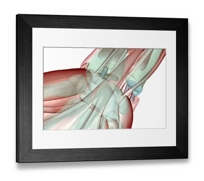 Framed Print : anatomy, close-up view, finger muscles, fingers, flexor retinaculum, front view, hand Framed Print : anatomy, close-up view, finger muscles, fingers, flexor retinaculum, front view, hand