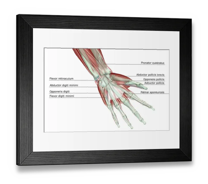 Framed Print : abductor digiti minimi, abductor pollicis brevis, adductor pollicis, anatomy, finger muscles Framed Print : abductor digiti minimi, abductor pollicis brevis, adductor pollicis, anatomy, finger muscles