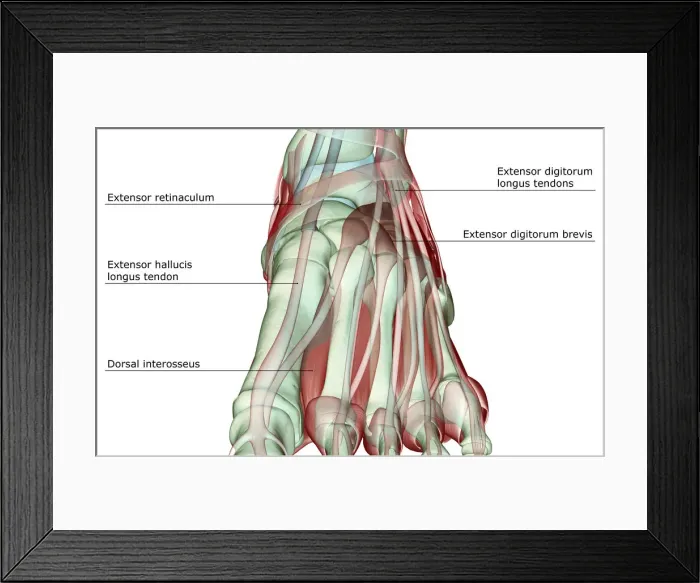 Framed Print : anatomy, dorsal interosseus, extensor digitorum brevis, extensor digitorum longus tendons Framed Print : anatomy, dorsal interosseus, extensor digitorum brevis, extensor digitorum longus tendons