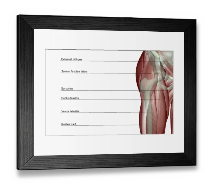 Framed Print : above view, anatomy, close-up view, front view, hip, hip muscles, human, illustration Framed Print : above view, anatomy, close-up view, front view, hip, hip muscles, human, illustration