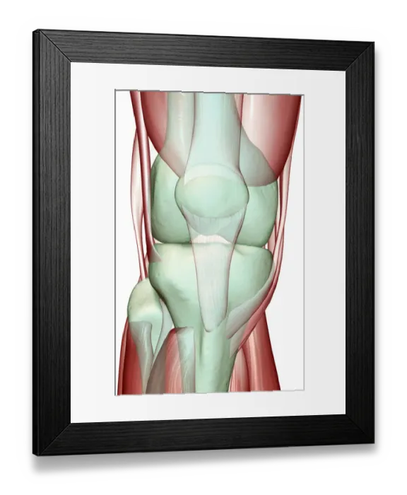 Framed Print : anatomy, close-up view, front view, human, illustration, knee, knee muscles, knee tendons Framed Print : anatomy, close-up view, front view, human, illustration, knee, knee muscles, knee tendons