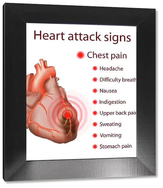 Heart attack signs, illustration