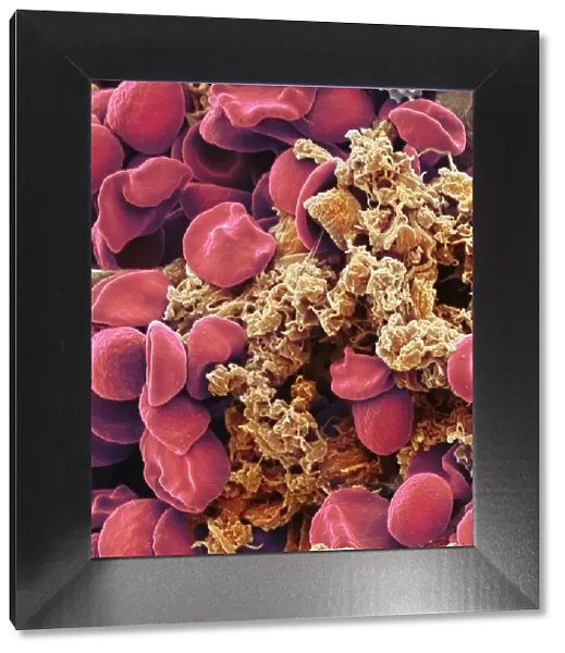 Red blood cells and platelets, SEM