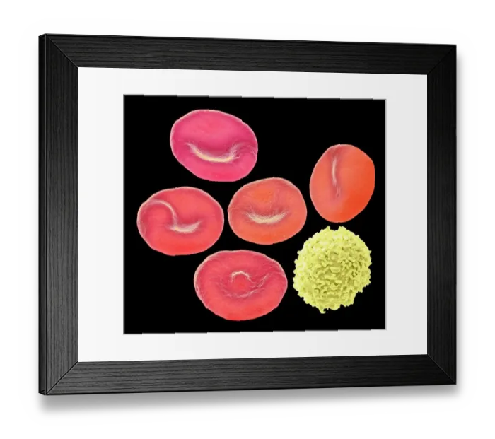 Framed Print : Blood cells, SEM Framed Print : Blood cells, SEM