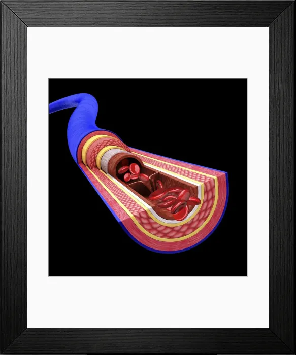 Framed Print : Human vein, artwork