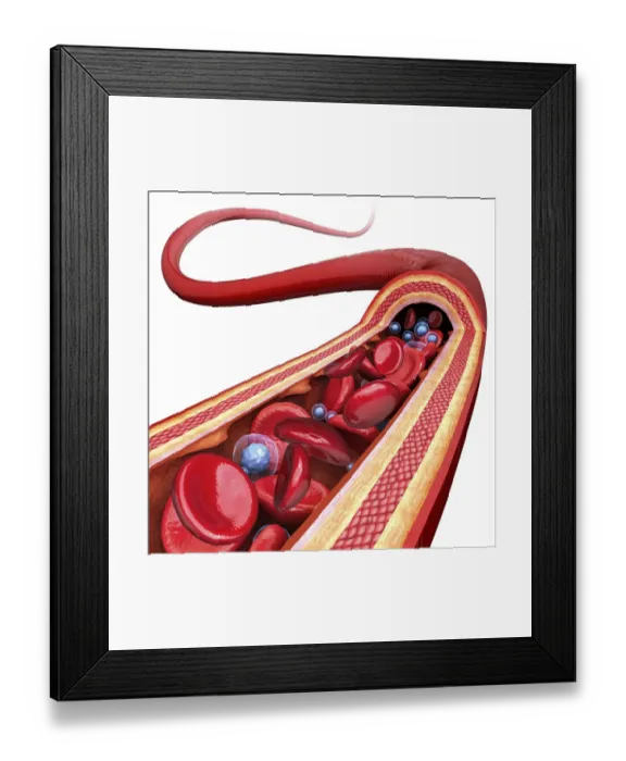 Framed Print : Human artery, artwork Framed Print : Human artery, artwork
