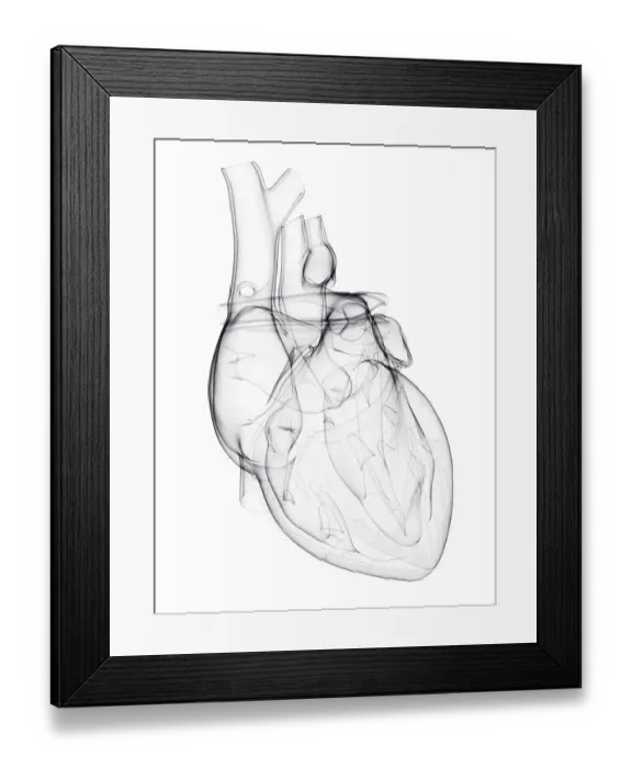 Framed Print : Human heart, artwork Framed Print : Human heart, artwork