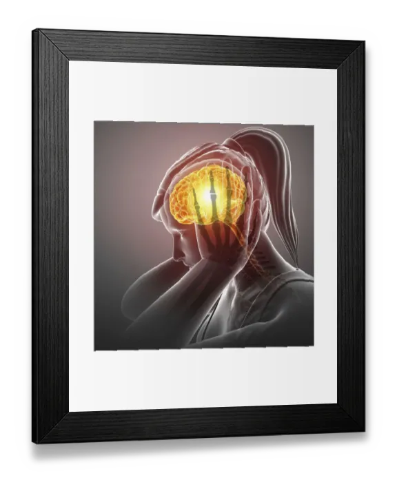 Framed Print : Woman with headache, illustration Framed Print : Woman with headache, illustration