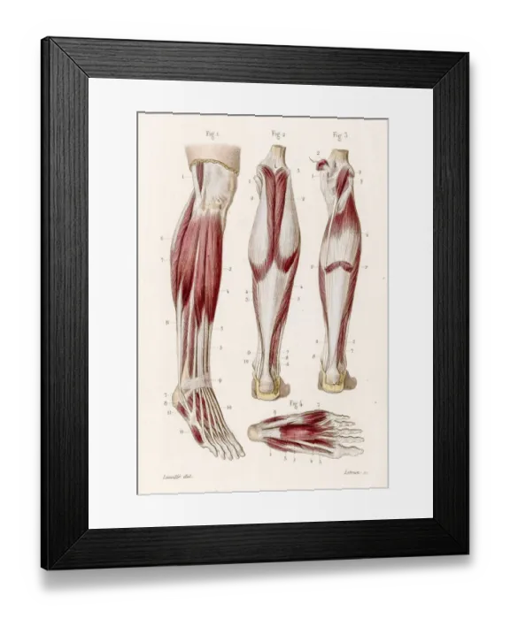 Framed Print : Muscle leg and foot anatomy engraving 1886 Framed Print : Muscle leg and foot anatomy engraving 1886