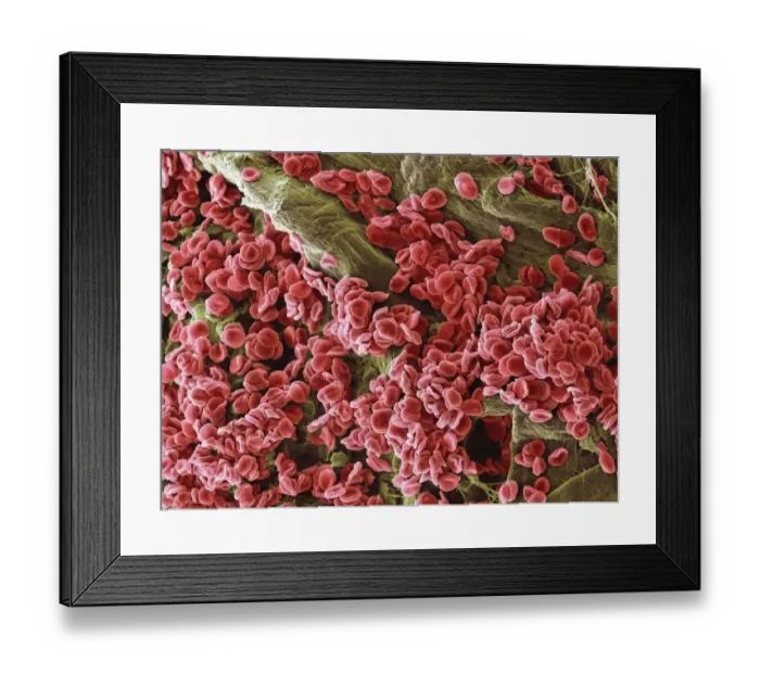 Framed Print : Red blood cells, SEM Framed Print : Red blood cells, SEM