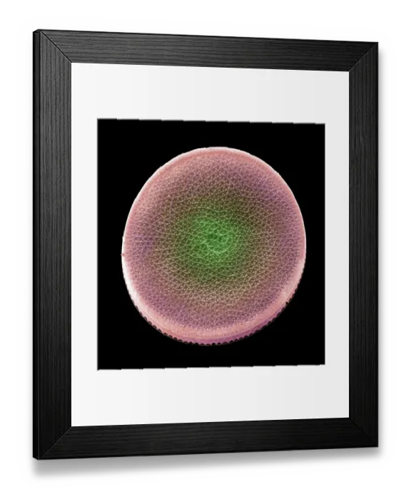 Framed Print : Colored scanning electron micrograph(SEM) Framed Print : Colored scanning electron micrograph(SEM)