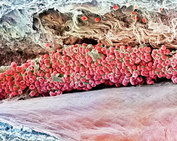 Scanning electron micrograph (SEM) of red blood cell
