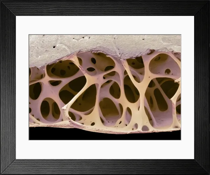 Framed Print : Bird bone tissue, SEM Framed Print : Bird bone tissue, SEM