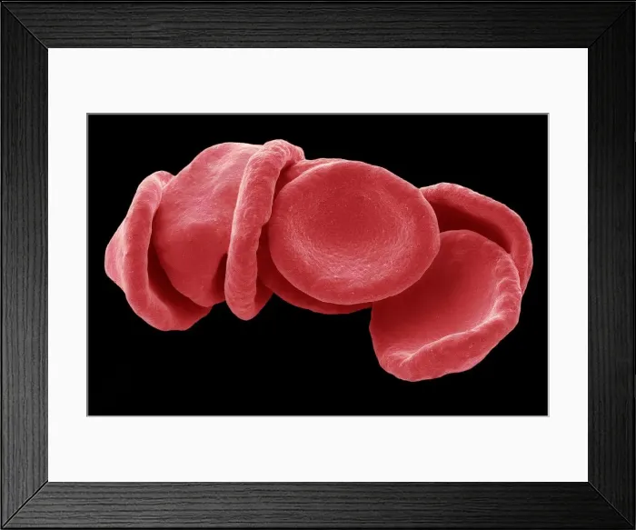 Framed Print : Red blood cells, SEM