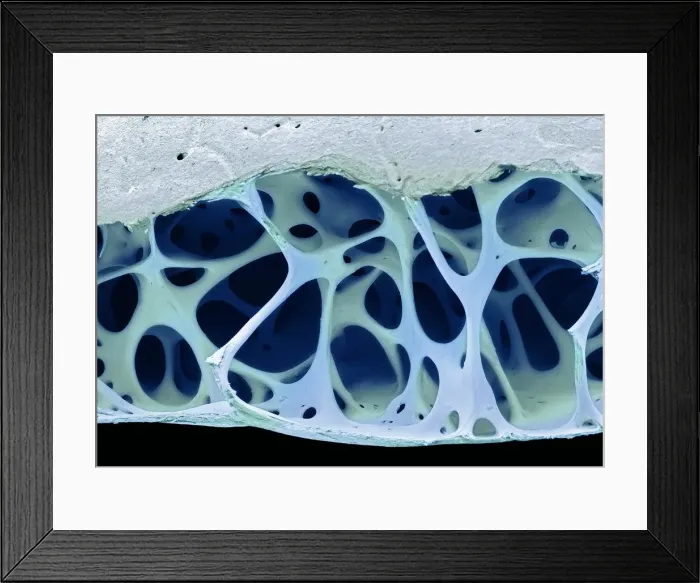 Framed Print : Bird bone tissue, SEM Framed Print : Bird bone tissue, SEM